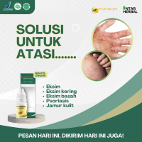 Tetes Eksim Kulit Salep Propolis SM Untuk Eksim, Eksim Di Tangan, Eksim Di Kaki, Eksim Kering/Basah,
