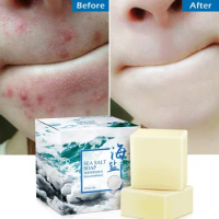 100g Sea Salt Soap Removal Pimple Pores Acne Treatment Cleanser Moisturizing Goat Milk Face Wash Handmade Soap Base Skin Care