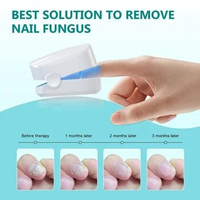Nail Fungus Laser Treatment Device For Toenail Fingernail Fungus Treatment Extra Strength Treat OnychomycosisToe Nail Fungus