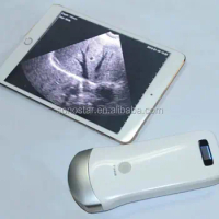 UProbe-2 wireless probe iPad ultrasonic scanner for sale