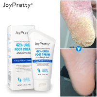 Foot Dead Skin Remover Cream Exfoliator Urea Anti Drying Feet Callus Heel Cracking Treatment Hands Legs Skin Care Foot Mask