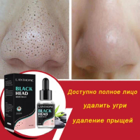 Salicylic Acid Blackhead Whitehead Remover Deep Cleansing Mask Whitening Gentle Blackhead Removal Exfoliating Skin-friendly Face