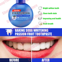 Whitening Teeth Removes Coffee Smoke Stains Fresh Breath Oral Hygiene Care Toothpaste Fast and Free Shipping
