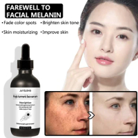 Removal Freckle Whitening Serum Fade Dark Spot Pigment Melanin Correcting Facial Essence Turmeric Oil Brighten Beauty Skin Care