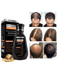 แชมพูปลูกเติบโต DHT สินค้าต้นฉบับจากอเมริกา