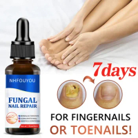 Fungal Nail Treatment Oil Foot Repair Essence Toe Nail Fungus Removal Gel Anti Infection Cream Fungal Nail Removal 10ML