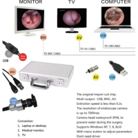 Direct connect to PC/TV for ENT diagnosis portable USB endoscope