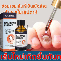 7 Day Nail Repair Serum น้ำยาซ่อมเล็บสำหรับนิ้วมือและนิ้วเท้าสีเทา
