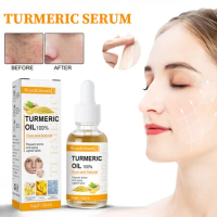 Turmeric Melasma Whitening Correcting Serum Facial Care Essence Oil Dark Spot Removal Fade Pigment Freckle Melanin Brighten Skin