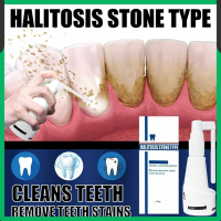 Tartar Removal Spray Buang Karang Gigi Whitening Teeth Cleaner Remove Dental Calculus Deodorizing Wa
