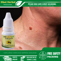 Penghilang Kutil Dan Tahi Lalat, Penghilang Kutil Di Leher, Penghilang Kutil Di Wajah, Penghilang Ku