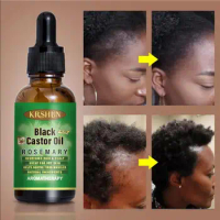 Ginger Black Castor Oil Nourishes Hair Growth Skin Massage Hair Loss Essential Oil Eyebrows Growth Hair Tonic Oil for Men Women