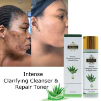 5D Gluta Aloe Vera Repairing Moisturising Toner Anti-Acne Brightening Hydrating Moisturising Natural Face Skin Care Products
