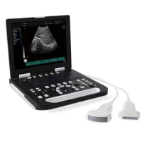 Full digital laptop ultrasound scanner SS-10