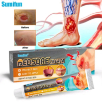 Bedsore Cream - Kream Luka Baring/Penyembuh Luka Diabetes/ Mengobati Luka Dekubitus