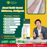 Propolis Sm Atasi Biduran Dan Gatal Gatal, Alergi Kulit Gatal Bentol Biduran, Gatal Biduran, Alergi