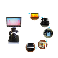 Factory Price 80000 Pixels Microcirculation Detector Capillaroscope Price