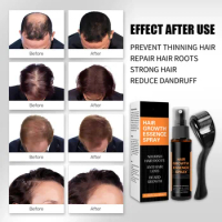 30ml Hair Growth Spray Anti Hair Loss Nourishing Growth Liquid Thick Hairline Essence Spray
