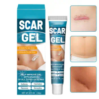 Stretch Marks Scar Gel Scar Removal Cream Legs Body Stretch Marks Repair Gel Acne Pimples Care For Pregnant