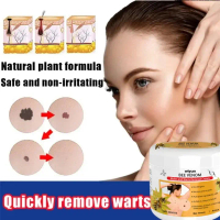 Penghilang Tahi Lalat Penghilang Kutil Wart Removal Serum Menghilangkan Tahi Lalat