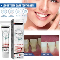 Dental Calculus Remover Whitening Teeth Toothpaste Brightening Preventing Periodontitis Removal Bad Breath Dental Cleansing Care