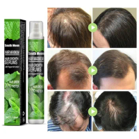 10/30ml Hair Growth Spray Fast Grow Hair Oil Hair Loss Cure for Thinning Hair Growth Spray Products Hair Care for Women Men