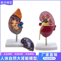 腎臟模型人體內臟病理結構自然大腎解剖附腎上腺模型標本腎部教具