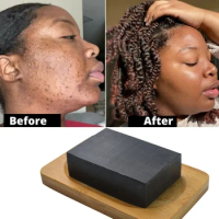 Original African Black Soap, Dark Spots Remover, Acne Remover, Clear Skin 100g