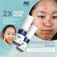 2x AC7D Serum Concentrated 10ml (Low Stock) - Acne Clear 7 Days | Acne Treatment for Acne-Prone Skin