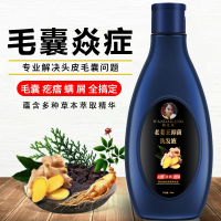 去屑止癢除蟎去蘚脂溢性頭皮頭屑頭皮毛囊焱炎脂溢性皮炎洗發水洗髮露 洗髮精 洗髮液 防脫髮
