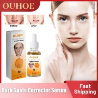 Turmeric Freckle Whitening Serum Fade Dark Spot Melasma Lighten Melanin Acne Scar Improve Pigment Anti Aging Brighten Skin Care