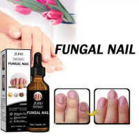 Nail Fungus Treatment Essence Anti Infection Paronychia Foot Removal Hand Onychomycosis Care Repair Nourishing 30ml Fungal O7Q7