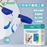 【限時優惠】夜用大腳骨拇趾外翻矯正器 | 腳指外翻矯正器 | 分趾器 | 拐骨大拇趾重疊分趾矯形糾正器-一對裝（JEW）