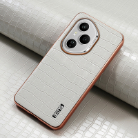 Ốp điện thoại cho Honor 400 Pro 400Pro Honor400 5G Honor400 Pro 5G Honor400Pro ốp điện thoại họa tiế