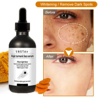 Nature Whitening Face Serum Turmeric Oil Brighten Removal Pigment Melanin Correcting Essence Beauty Skin Care