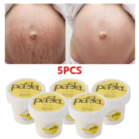 5X Scar Repair Cream Stretch Marks Remover Cream Obesity Mark Anti-Aging Firming Body Health Care For Postpartum Pregnant Women
