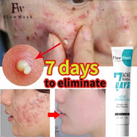Flow week Acne Control Salicylic Acid Gel Acne Spot Treatment Gel Cream with 2% Salicylic Acid Acne Medication Acne Skin Care