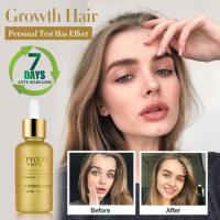 Hair Growth Essence Oil Anti Hair Loss Treatment for Hair Growth Hair Care Anti Preventing Hair Loss Products Hair Tonic Thick