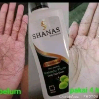 SHAMPO PERAWATAN RAMBUT RONTOK/SHSMPO PRMANJANG RAMBUT CEPAT/SHSMPP ANTI KETOMBE/SHAMPO PENGHILANG K