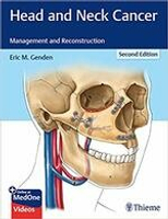 Head and Neck Cancer: Management and Reconstruction 2/e Genden  Thieme