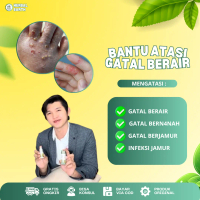 Cairan Tetes Untuk Gatal Berair Di Jari Tangan dan Kaki, Pereda Gatal Bintik Berair, Gatal Bernan4h,