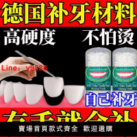 【台灣公司保固】進口快速補牙樹脂補牙臨時假牙縫填縫劑永久補牙材料假牙樹脂顆粒