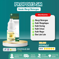 Propolis Sm Untuk Alergin Detergen Jari Tangan Kering Pecah Pecah Mengelupas Iritasi Jari Tangan Meg