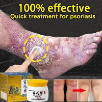 Eczema Psoriasis Cream Anti-Itching Antifungal Cream Herbal Formula Repairs Skin Private Part Itchy 