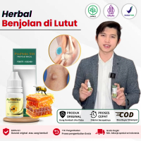 Propolis Sm Untuk Kista Baker Benjolan di Lutut Sudah Bpom dan Halal