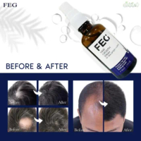 50mL FEG hair growth spray precent hair loss stimulate hair focile growth ownning Longer, thicker and healthier hair