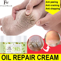 Flow Week Anti-dry Body 40% Urea Cream Dry Cracked Heels Foot Feet Hand Body Repair Treatment Softener for Feet Care