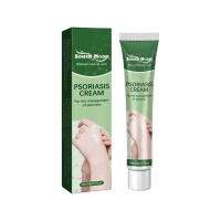 Krim Perbaikan Psoriasis South Moon Meredakan Kulit Gatal di Tangan dan Kaki Krim Perawatan Kulit Tu