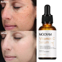 30ml Vitamin C Face Serum Whitening Freckle Fade Dark Spot Removal Pigment Melanin Correcting Vitamin C Serum with Retinol