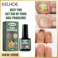 Nail Fungal Treatment Essence Oil Foot Toe Nail Fungus Removal Serum 7 Days Repair Onychomycosi Anti Infection Gel Care Products